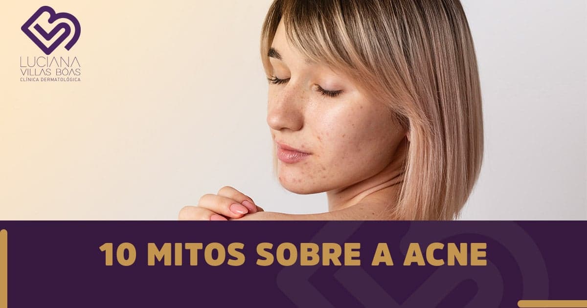 10 mitos sobre a Acne
